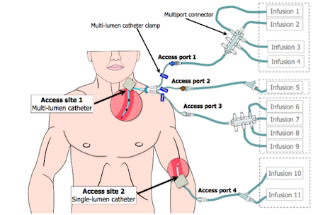 Piggyback system for intravenous therapy used in the hospital of the