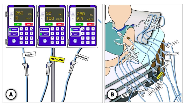 IV Secondary Line Infusion