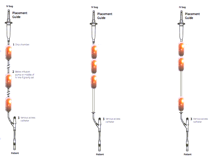 MLID Scenarios